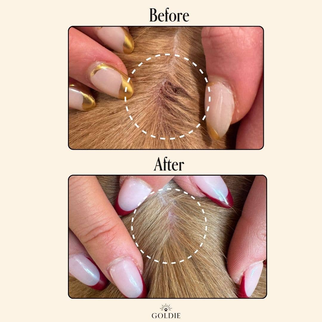 Two images show hands parting hair to reveal a scalp. The "Before" image shows dryness and irritation, while the "After" image appears healthier and smoother after using Goldie - Miracle Mist by Goldie.